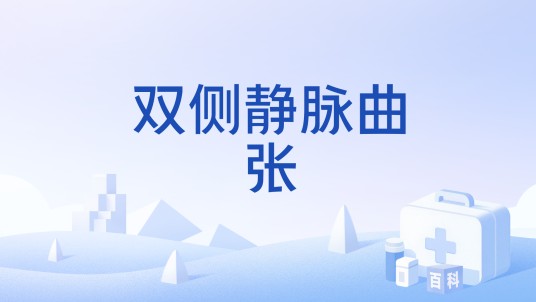 双侧静脉曲张