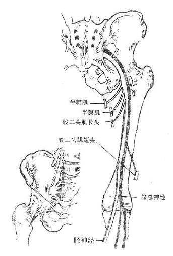 坐骨神经