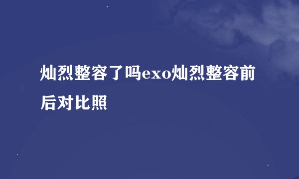 灿烈整容了吗exo灿烈整容前后对比照