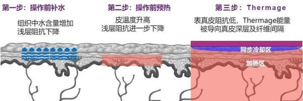 舒感索塔热玛吉是什么？是智商税吗？