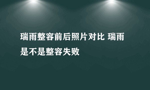 瑞雨整容前后照片对比 瑞雨是不是整容失败
