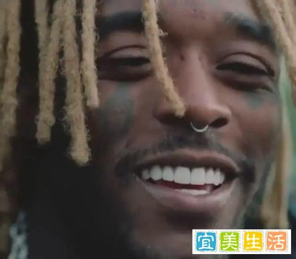 脑袋细菌感染...Uzi头上镶的1.5亿粉钻消失！网友可耻的笑喷了···
