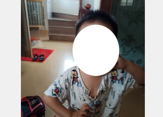 谁能告诉我手机上的美图秀秀怎么用白点挡脸??