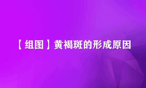 【组图】黄褐斑的形成原因