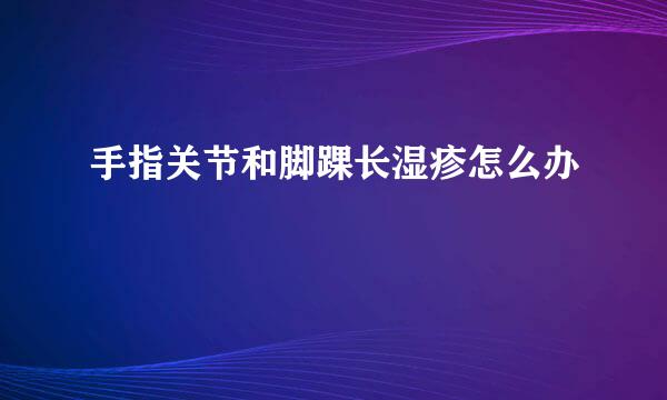 手指关节和脚踝长湿疹怎么办