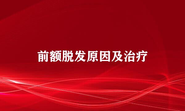 前额脱发原因及治疗
