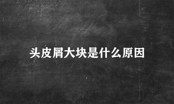 头皮屑大块是什么原因