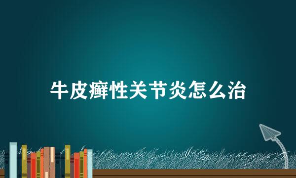 牛皮癣性关节炎怎么治