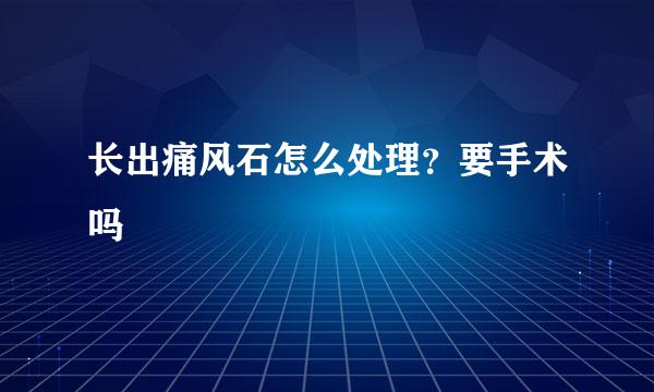 长出痛风石怎么处理？要手术吗