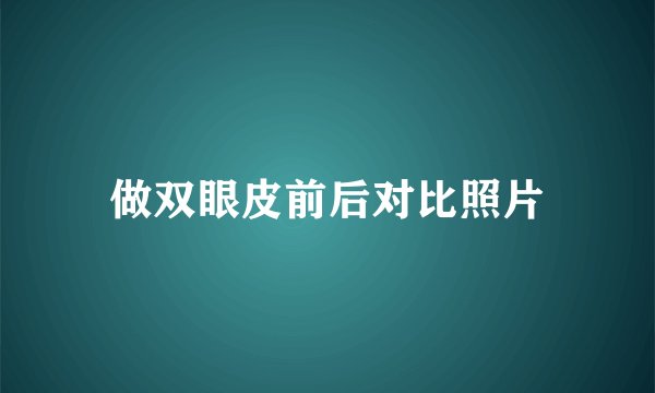 做双眼皮前后对比照片