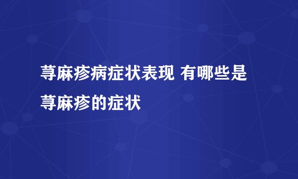荨麻疹病症状表现 有哪些是荨麻疹的症状