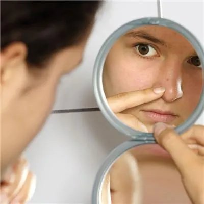 脸上的雀斑如何去除