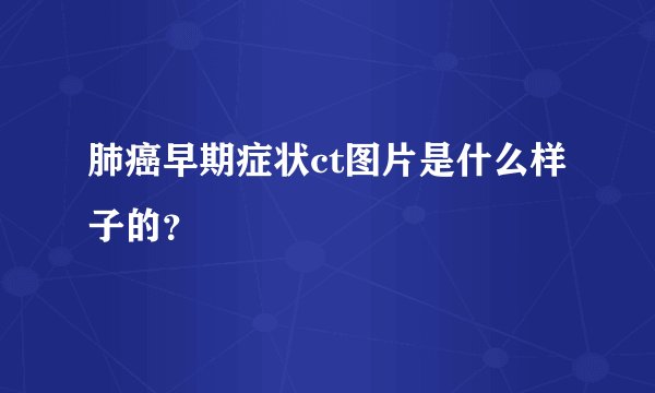 肺癌早期症状ct图片是什么样子的？