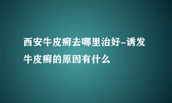 西安牛皮癣去哪里治好-诱发牛皮癣的原因有什么