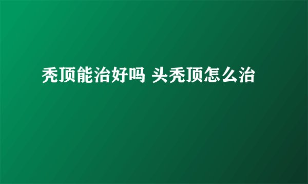 秃顶能治好吗 头秃顶怎么治