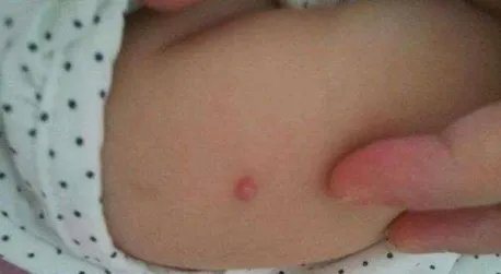 多名孩子身上出现针眼,为何作为老师都如此狠心?