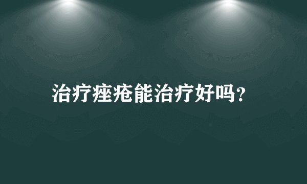 治疗痤疮能治疗好吗？