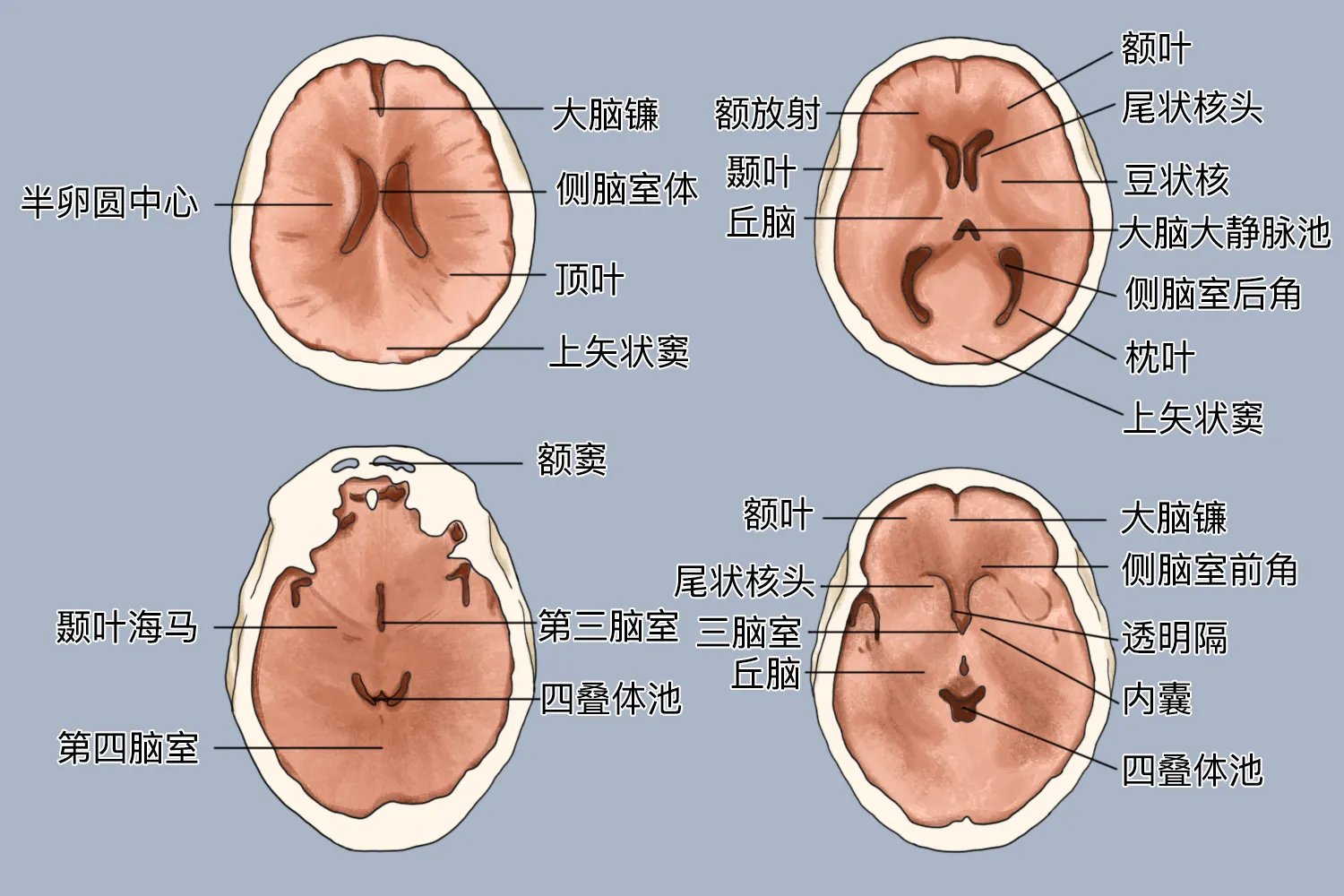颅脑CT解剖图