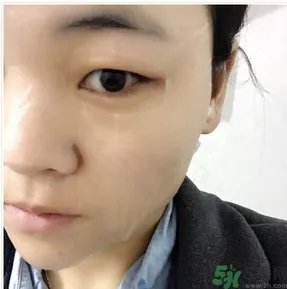 丽得姿面膜用后要洗吗?丽得姿面膜要不要洗?