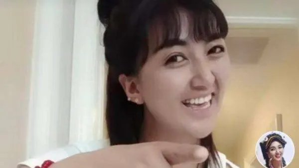 知名网红拉姆遭前夫纵火烧伤,她与前夫之间到底有何仇怨?
