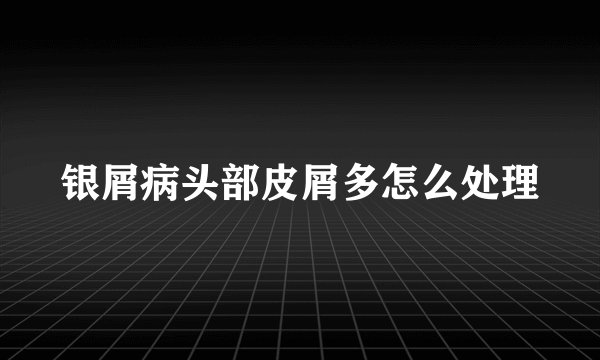 银屑病头部皮屑多怎么处理