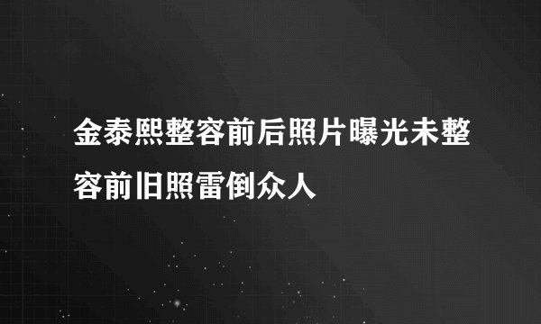 金泰熙整容前后照片曝光未整容前旧照雷倒众人