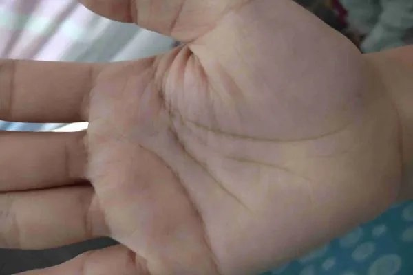 生命线越短寿命越短是真的吗?