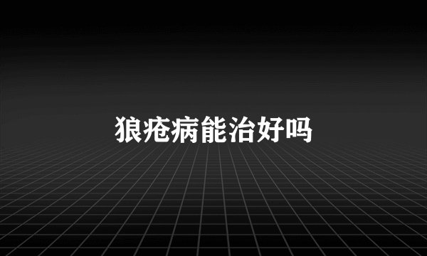 狼疮病能治好吗