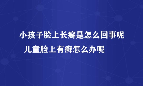 小孩子脸上长癣是怎么回事呢 儿童脸上有癣怎么办呢