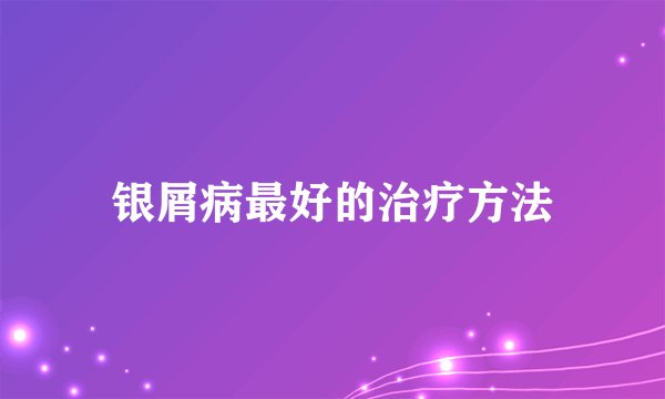 银屑病最好的治疗方法