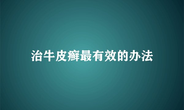 治牛皮癣最有效的办法