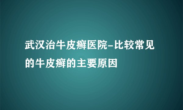 武汉治牛皮癣医院-比较常见的牛皮癣的主要原因