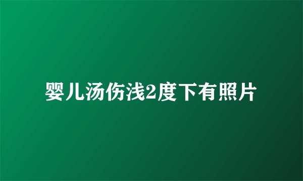 婴儿汤伤浅2度下有照片