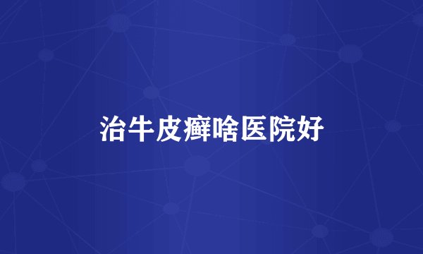 治牛皮癣啥医院好