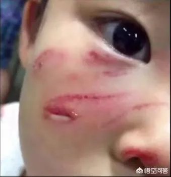 顺丰拿到国内首张无人机航空许可证，如果无人机掉下来砸到人，怎么办？