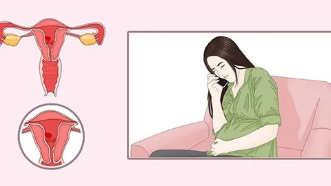 刮宫最佳时间