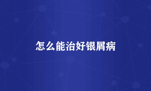 怎么能治好银屑病