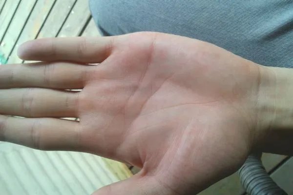 生命线越短寿命越短是真的吗?
