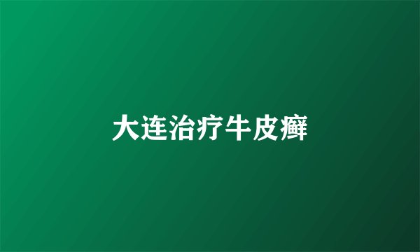 大连治疗牛皮癣