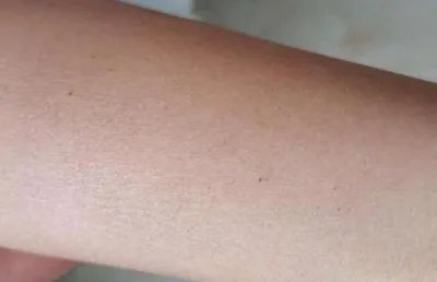 多名孩子身上出现针眼，为何作为老师都如此狠心？