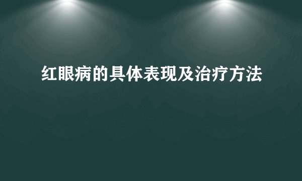 红眼病的具体表现及治疗方法