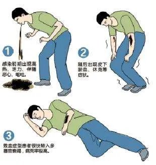 猪链球菌症状