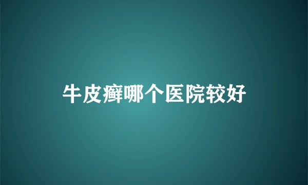 牛皮癣哪个医院较好