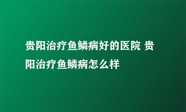 贵阳治疗鱼鳞病好的医院 贵阳治疗鱼鳞病怎么样