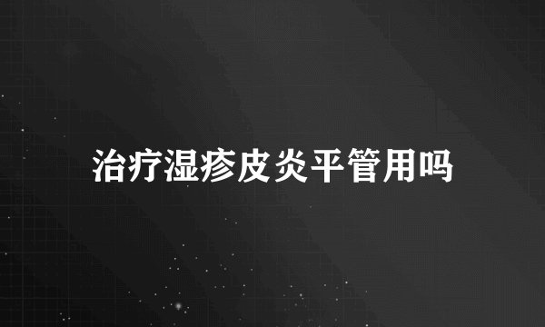 治疗湿疹皮炎平管用吗