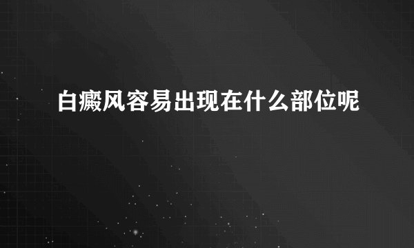 白癜风容易出现在什么部位呢