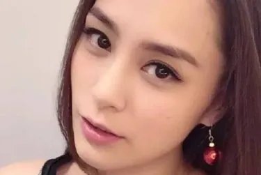 阿娇受伤后首露面,是否存在故意遮挡伤口的行为?