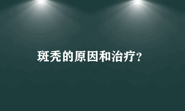 斑秃的原因和治疗？