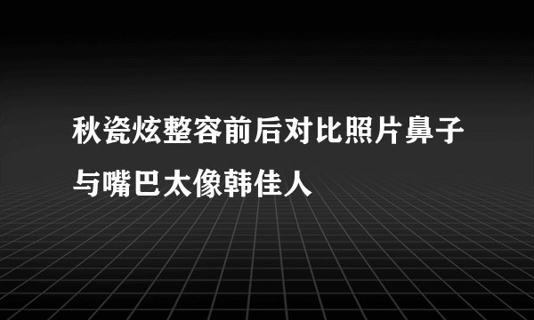 秋瓷炫整容前后对比照片鼻子与嘴巴太像韩佳人