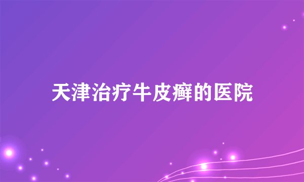 天津治疗牛皮癣的医院